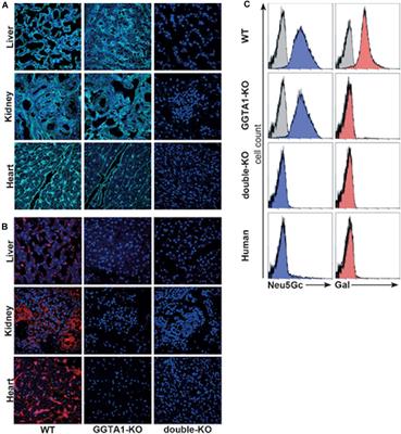 The Possible Role of Anti-Neu5Gc as an Obstacle in Xenotransplantation